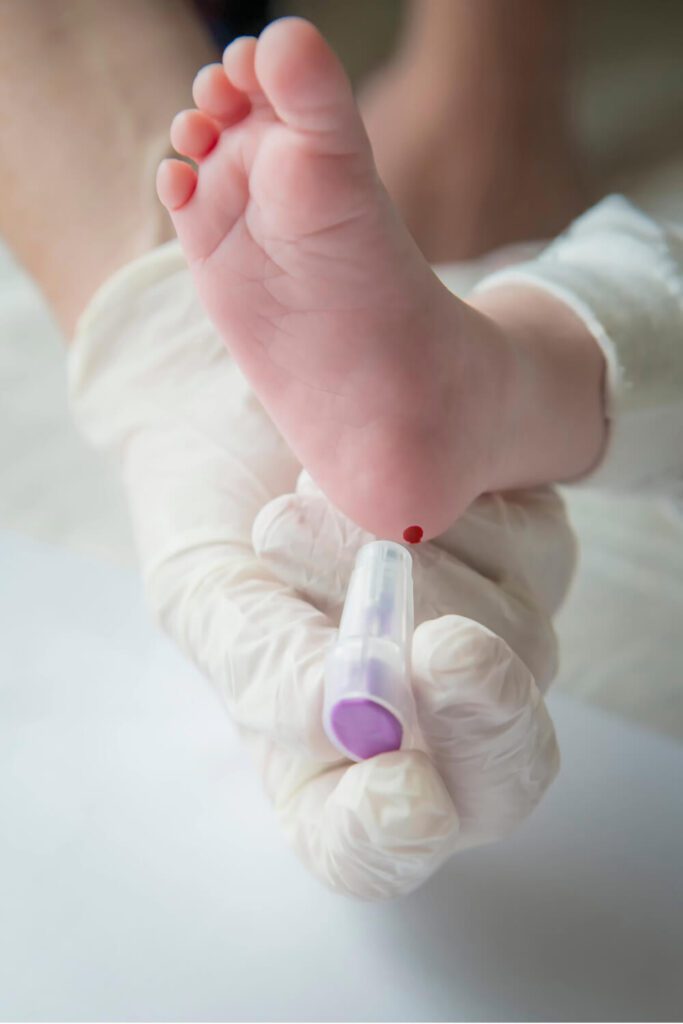 Capillary blood sampling at the bedside